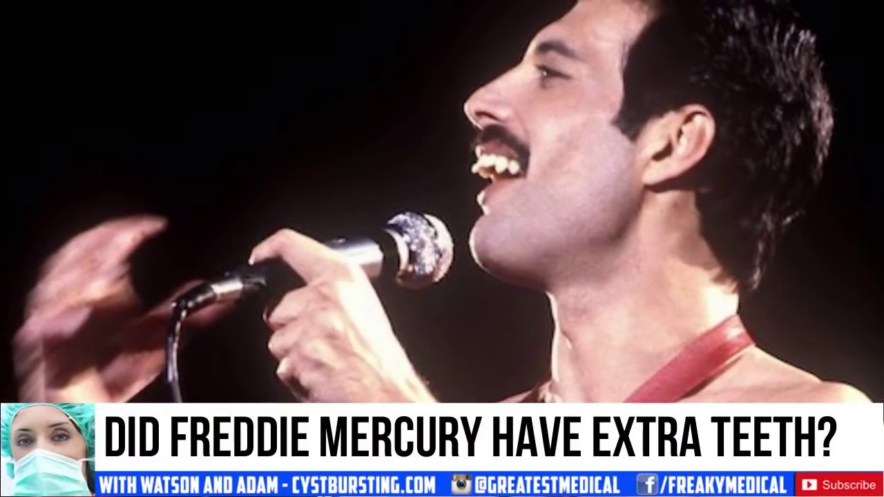 Did Freddie Mercury really have extra teeth?