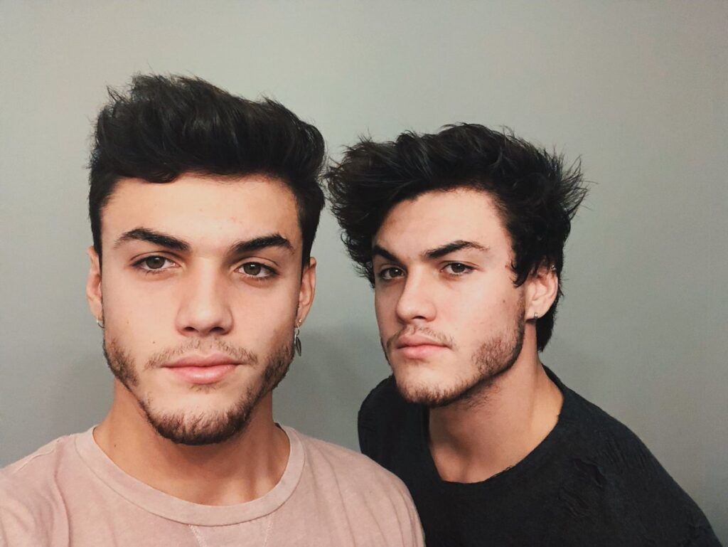 What surgery did the Dolan twins get?
